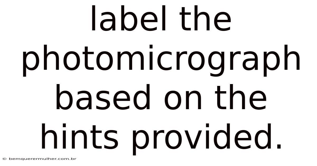 Label The Photomicrograph Based On The Hints Provided.
